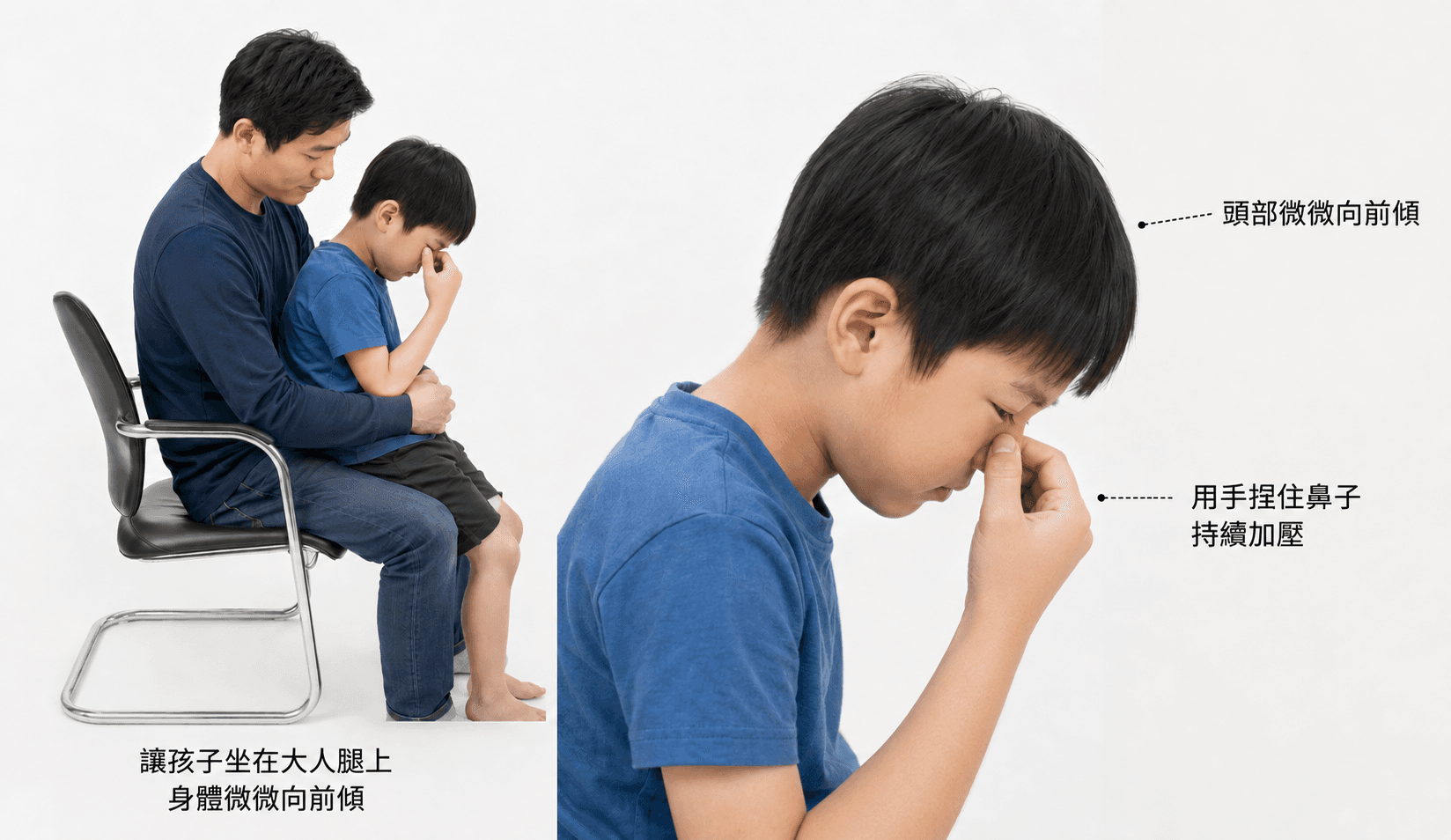 正確捏鼻翼加壓止血